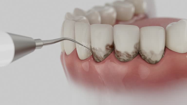 Reliable Dental Implants contractor in Squirrel Mountain Valley, CA by Smile Center Dentistry